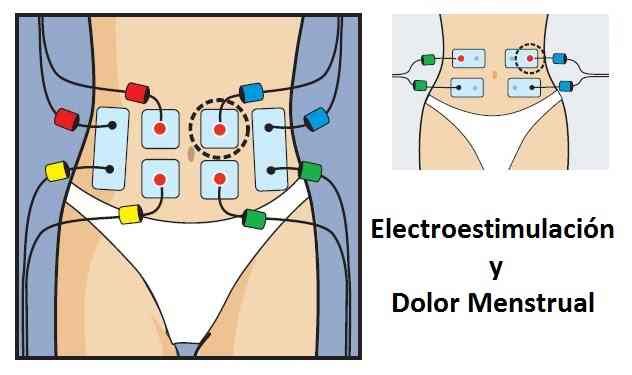 eletroestimulacao-e-dor-menstrual