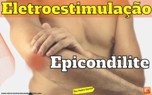 Epicondilite e tratamento com eletroestimulação