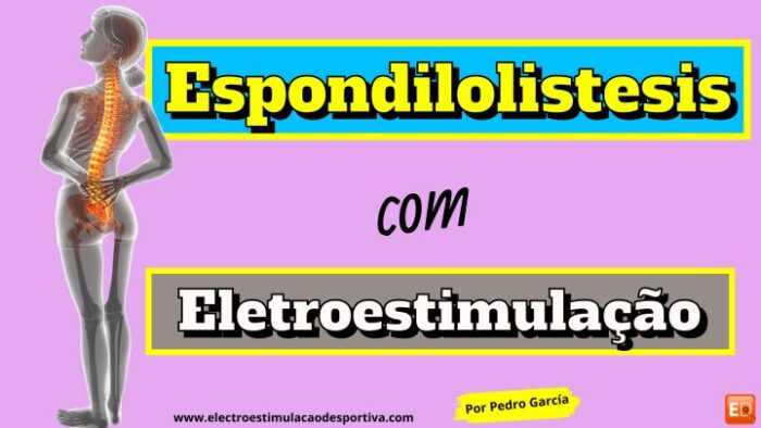 Espondilolistese lombar